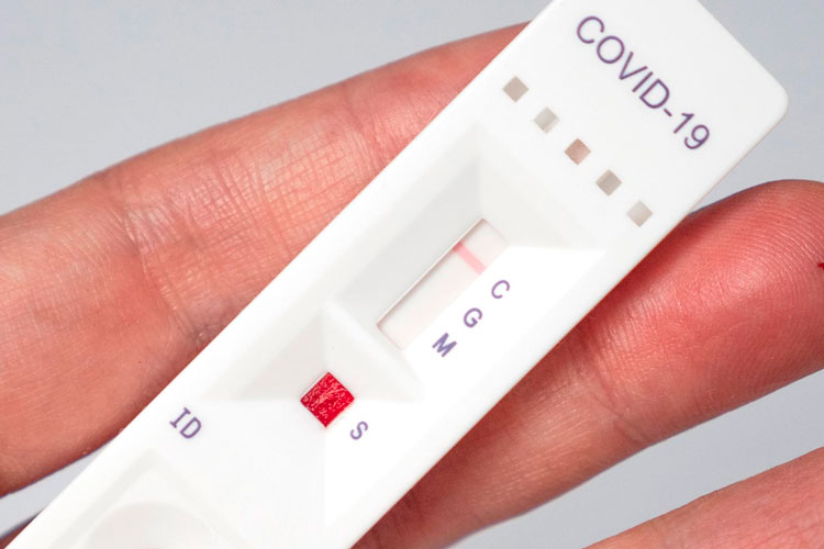 Las farmacias comienzan a vender test de autodiagnóstico